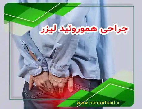 عمل هموروئید یا بواسیر با لیزر در لشکرک