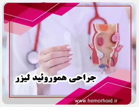 درمان هموروئید با لیزر